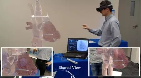 HoloLens首个人工智能+ar辅助医疗教学案例