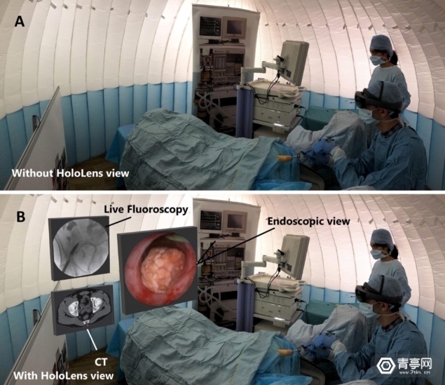 真实调查：用AR辅助微创手术究竟好在哪？