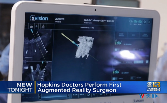 约翰霍普金斯大学用AR图像引导完成美国首列脊柱融合术